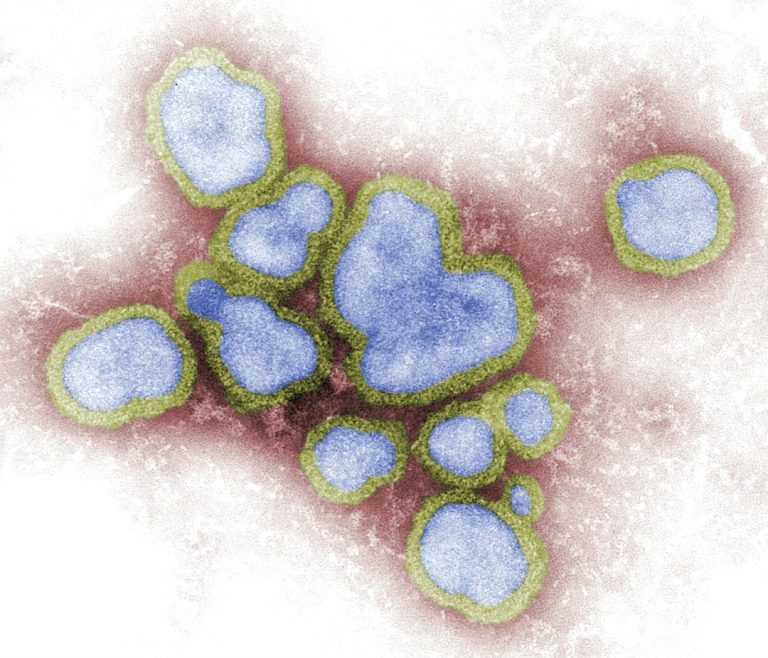 How to Support Your Immune System